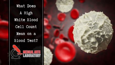 White blood cells are created inside the bone marrow, the spongy tissue inside bones. Do You Need a Testosterone Blood Test? Check Your Low T ...