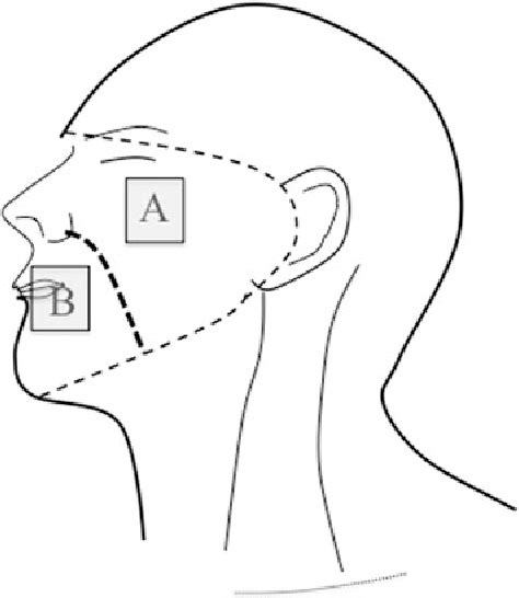Dominant Lymph Drainage In The Facial Region Evaluation Of Lymph Nodes
