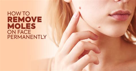 How To Remove Moles On Face Permanently Visit Dermatologist