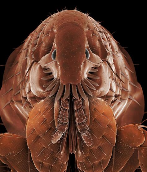 Cat flea bite symptoms on humans. Aggie MacKenzie reveals why a flea infestation could be ...