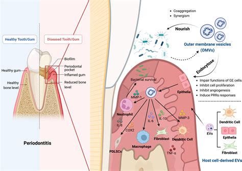 Frontiers The Role Of Extracellular Vesicles In Periodontitis Pathogenesis Diagnosis And