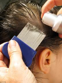 Black people have very curly hair and brushing through it would be a very difficult task to manage for getting the lice out. How To Get Rid Of Lice Eggs - TopCleaningTips.com
