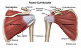 A rotator cuff injury can cause a dull ache in the shoulder, which often worsens with use of the arm away from the body. Rotator Cuff Muscles Illustration by Marie Dauenheimer | Medical Illustration & Animation