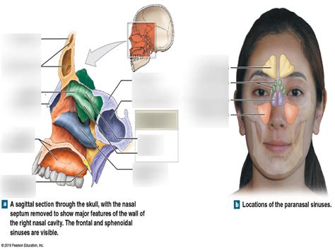 Chapter 7 Nasal And Paranasal Sinuses Diagram Quizlet