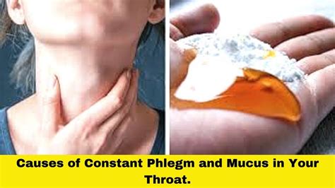 Causes Of Constant Phlegm And Mucus In Your Throat Constantly Cleari