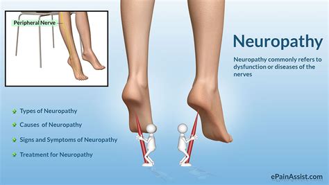 How To Repair Nerve Damage In Foot Physicn