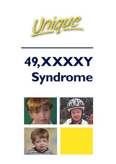 49xxxxy Syndrome Unique The Rare Chromosome Disorder