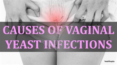 Causes Of Vaginal Yeast Infections Youtube