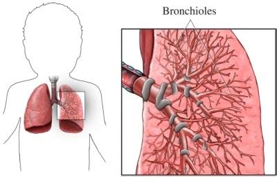 Anfis Fisioterapia Bronquiolitis Y Fisioterapia Respiratoria