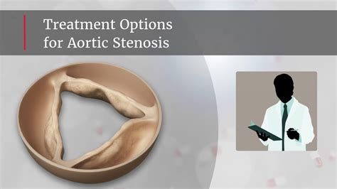 Your Aortic Stenosis Treatment Options