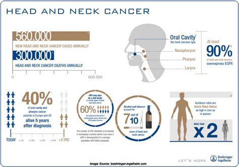 Head And Neck Cancer Diagram
