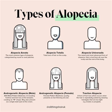 What Are The 3 Types Of Alopecia 27f Chilean Way
