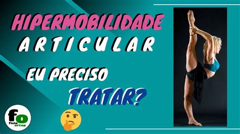 Hipermobilidade Articular Eu Preciso Tratar YouTube