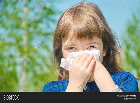 Seasonal Allergy Child Image And Photo Free Trial Bigstock
