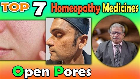 Open Pores Causes Symptoms And Homeopathy Treatment Dr P S Tiwari