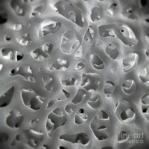 Cancellous Bone Photograph By Science Picture Co Pixels