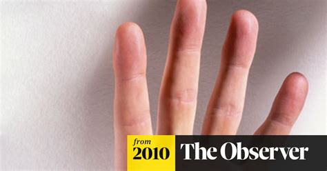 Men Measure Their Fingers To Check Their Risk Of Prostate Cancer