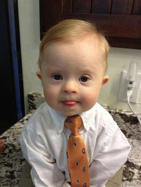 Cute Baby With Down Syndrome Who Else Thinks He S Handsome Artofit