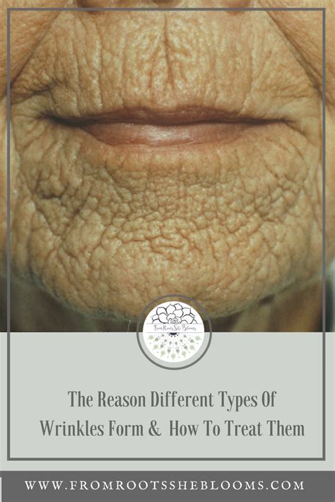 The Reason Different Types Of Wrinkles Form Different Types Type