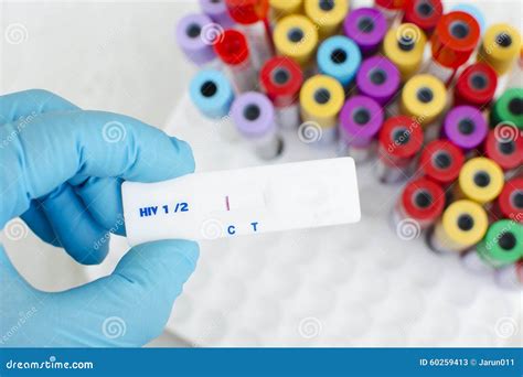 Hiv Testing Negative Stock Image Image Of Exam Negative 60259413