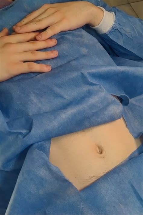 I Had My Belly Button Surgically Removed — No One Understands Why
