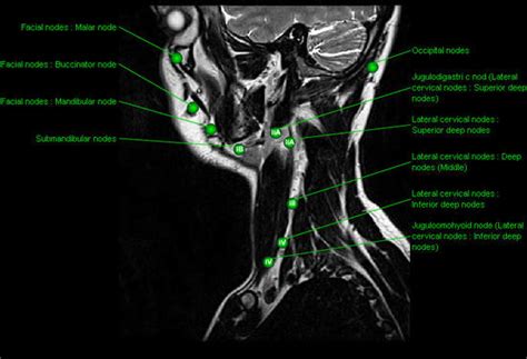 Anatomy Of The Face And Neck Mri