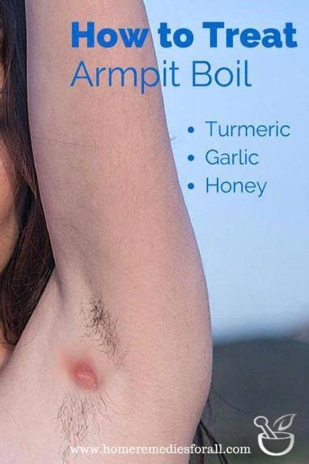 Exfoliating regularly will soften the skin and make it smoother. Armpit Lump Groin #LoseWeightbeHealthy #DrySkinLump in ...