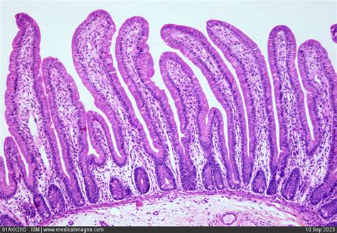 Stock Image Duodenum Normal Duodenal Villi Histological Section Light