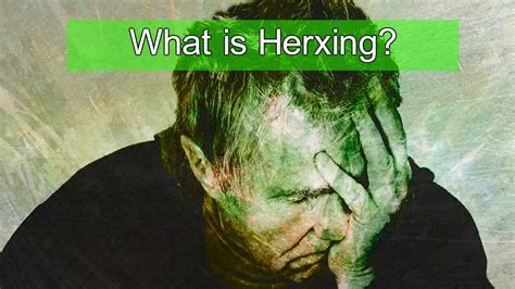 An increase in the symptoms of a spirochetal disease (as syphilis, lyme disease, or relapsing fever) occurring in some persons when treatment with spirocheticidal drugs is started —called also herxheimer reaction. What is Herxing? | What is Lyme Disease?