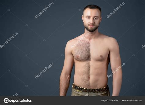 Hairy Male Chest Shaved On One Half Unshaven Mans Body The Man Shaves