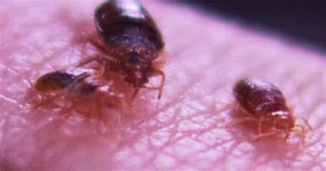 10 Most Terrifying Parasites Ever Cbs News