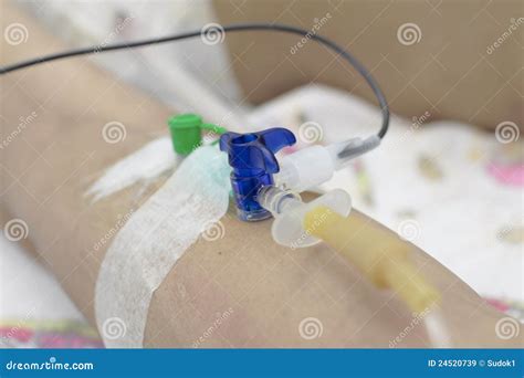 Catheter Into The Vein Stock Image Image Of People 24520739