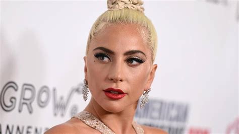 Lady Gaga Gets Entire Body X Rayed After Falling Off Stage With Fan