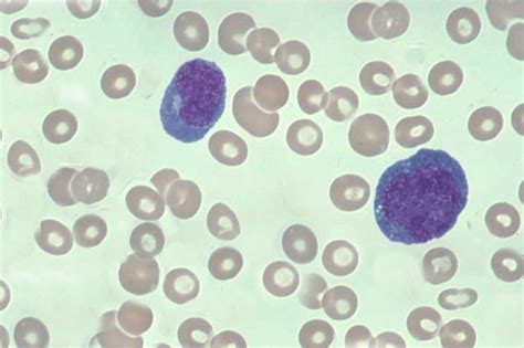 Medical Laboratory And Biomedical Science Leukocytes In Peripheral Blood