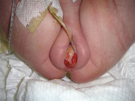 Female Hymen Piercing