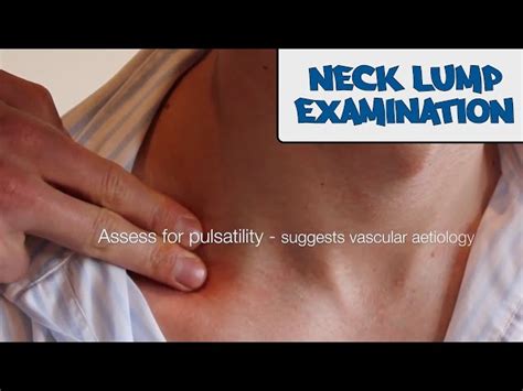 Neck Lump Examination New Version Free Medical Videos