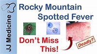Rocky Mountain Spotted Fever | Bacteria, Signs & Symptoms, Diagnosis ...