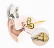 Wie funktioniert ein Cochlea-Implantat (CI)? - Hörakustik Jens Pietschmann