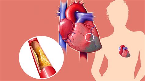 10 Surprising Facts About Cholesterol | Everyday Health
