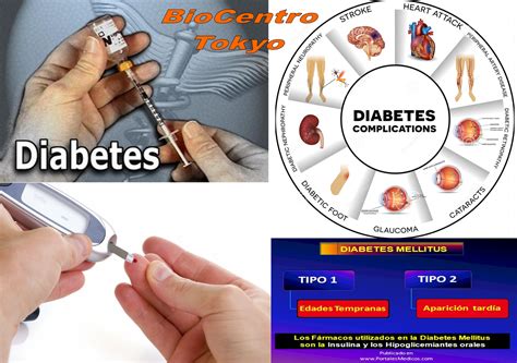 Diabetes Mellitus La Cura Natural Oculta Para Muchos Página Web De