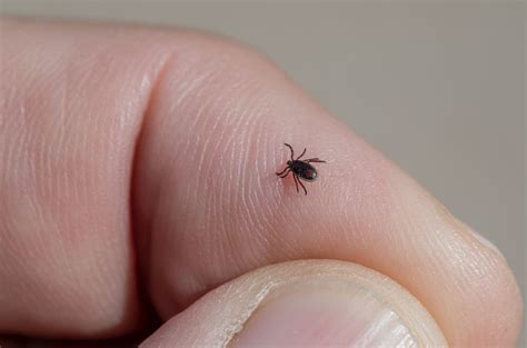 The Dangers Of Ticks How To Protect Yourself From Lyme Disease Sickday