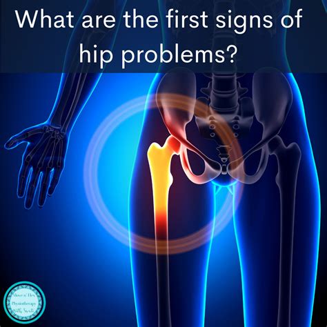 What Are The First Signs Of Hip Problems Swati Prakash