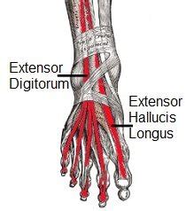 Tried running again on day 3 and it hurt again. Extensor Tendonitis: Top of Foot Pain