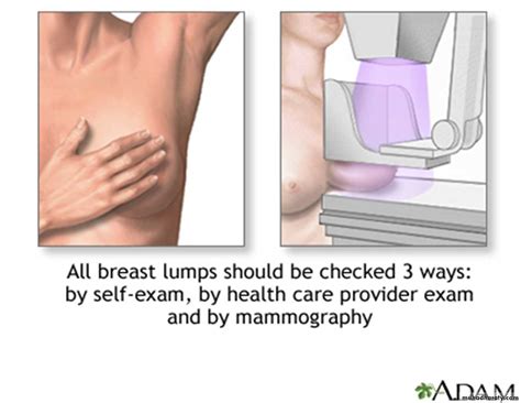 Your gateway to medical unusual dimpling in the breast which may indicate adhesion to underlying structures. Mammogram docx - Mammogram - Muhadharaty