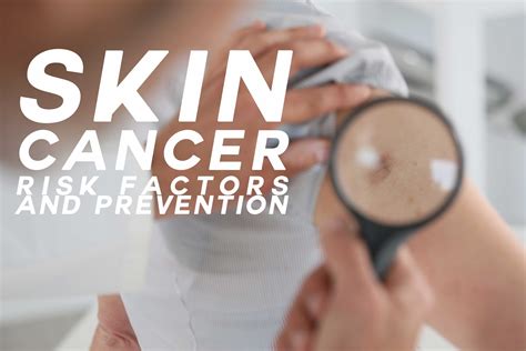 Watch Out Your Epidermis Is Exposed Skin Cancer Risk Factors And Prevention Ica Agency