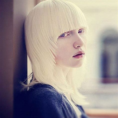 Nastya Zhidkova The Most Beautiful Albino In The World Photography