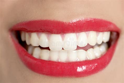 Beautiful Woman Perfect Teeth Smile Stock Photo Image Of Happiness