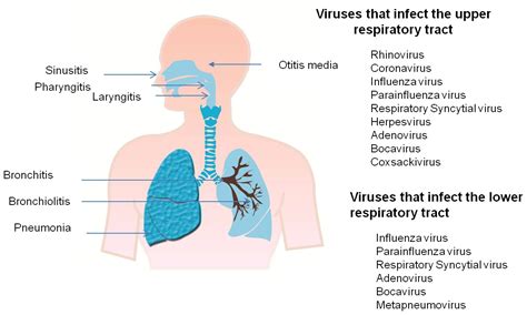 Lower Respiratory Tract Disease Lung Disease