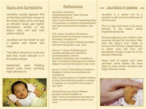 What Is Jaundice In Babies Nhs Get More Anythinks