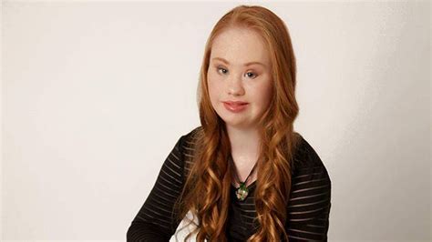 Madeline Stuart Model Wont Let Down Syndrome Hold Her Free Download Nude Photo Gallery